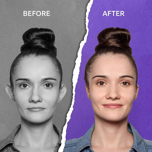 Non-Surgical Ear Clips: Gentle Correction for Prominent Ears